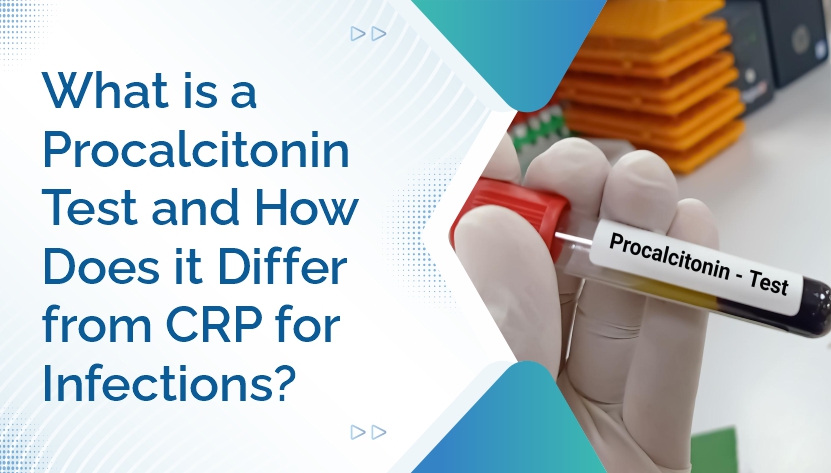 What Is a Procalcitonin Test and How Does It Differ from CRP for Infections?